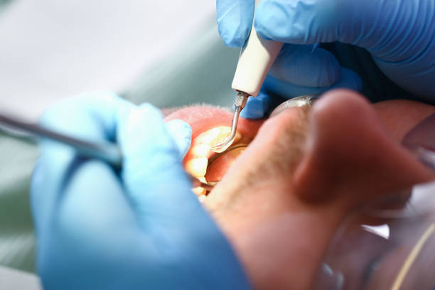 Best Pediatric Emergency Dentist in Union City, TN