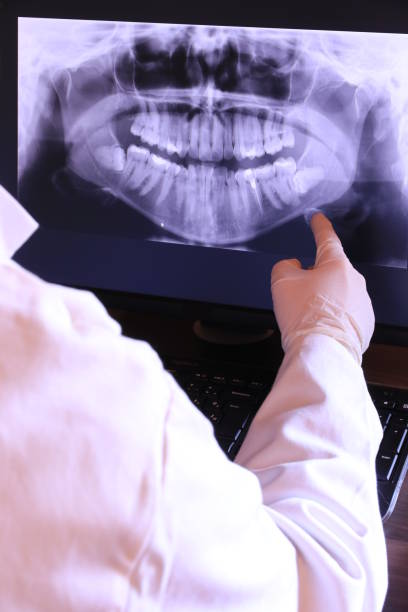 Best Emergency Broken Tooth Repair in Union City, TN